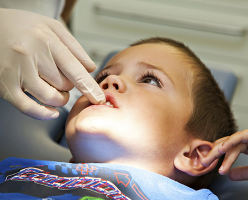Difficoltà respiratoria nasale e alterazioni craniomandibolari in età pediatrica
