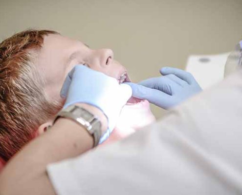 Carie nei denti da latte: fattori di rischio per la malocclusione