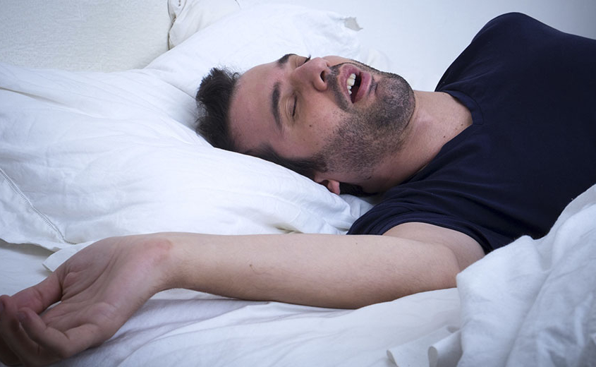 Osas apnee notturne e ortodonzia Osas apnee notturne e ortodonzia