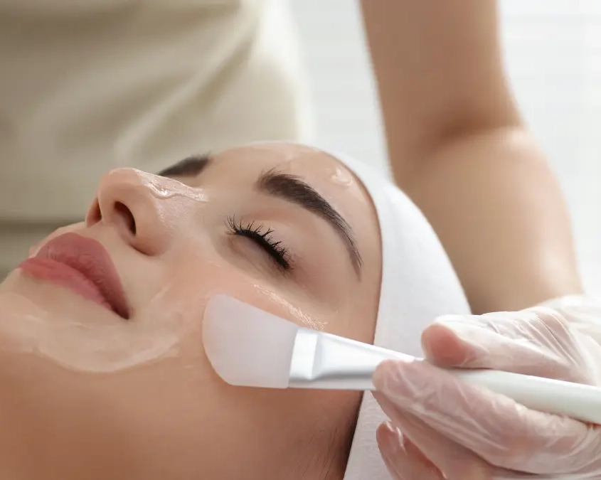 Cos’è il peeling chimico e quando ha senso per valorizzare il sorriso: differenze tra superficiale/medio/profondo, recupero, risultati e sicurezza.